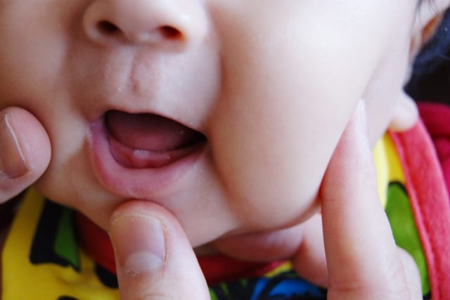 kiểm tra răng của em bé
